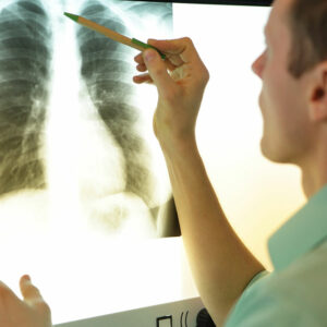 MAC lung disease – 8 common signs and management options
